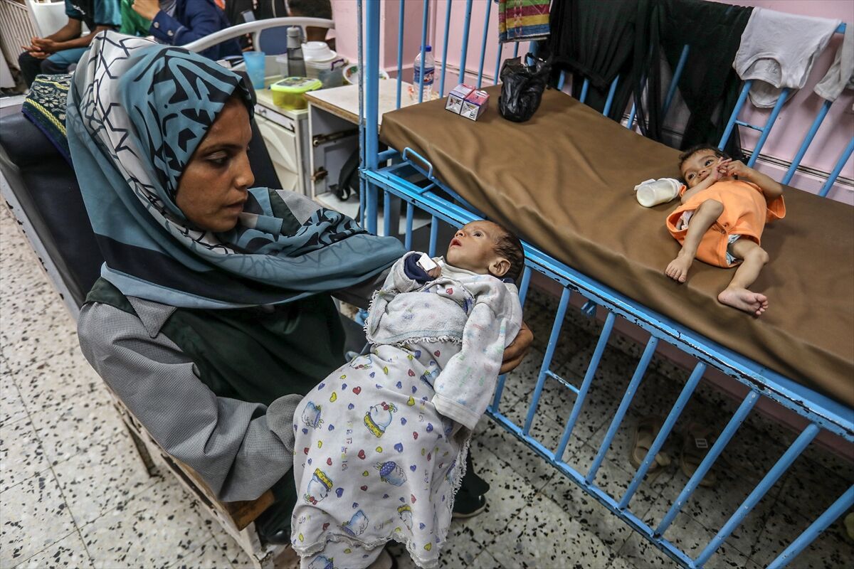 A A 20250724 38649236 38649227 K I T L E S E L A C L I K K R I Z I N I N D E R I N L E S T I G I G A Z Z E D E H A S T A N E L E R O L U M L E P E N C E L E S E N B E B E K L E R L E D O L U P T A S I Y O R