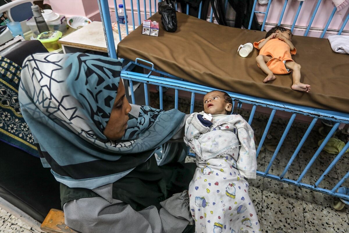 A A 20250724 38649236 38649228 K I T L E S E L A C L I K K R I Z I N I N D E R I N L E S T I G I G A Z Z E D E H A S T A N E L E R O L U M L E P E N C E L E S E N B E B E K L E R L E D O L U P T A S I Y O R