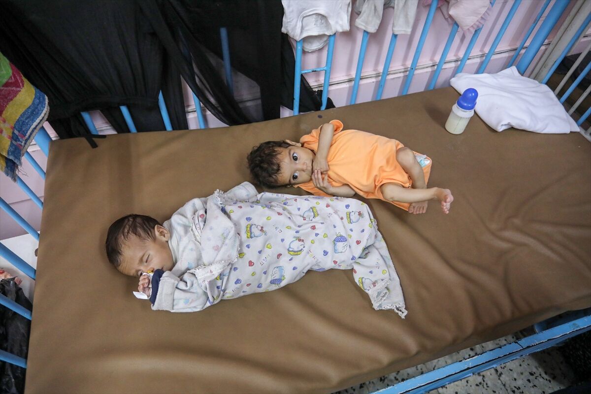 A A 20250724 38649236 38649230 K I T L E S E L A C L I K K R I Z I N I N D E R I N L E S T I G I G A Z Z E D E H A S T A N E L E R O L U M L E P E N C E L E S E N B E B E K L E R L E D O L U P T A S I Y O R