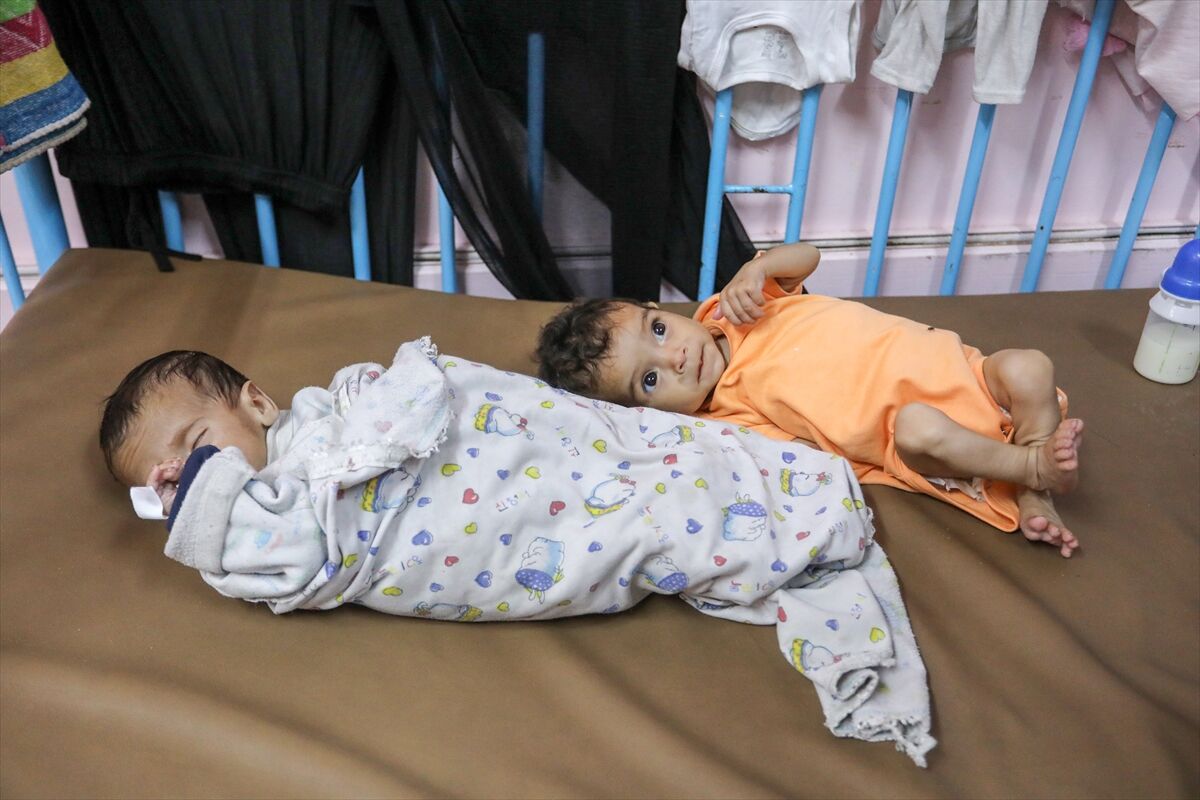 A A 20250724 38649236 38649231 K I T L E S E L A C L I K K R I Z I N I N D E R I N L E S T I G I G A Z Z E D E H A S T A N E L E R O L U M L E P E N C E L E S E N B E B E K L E R L E D O L U P T A S I Y O R