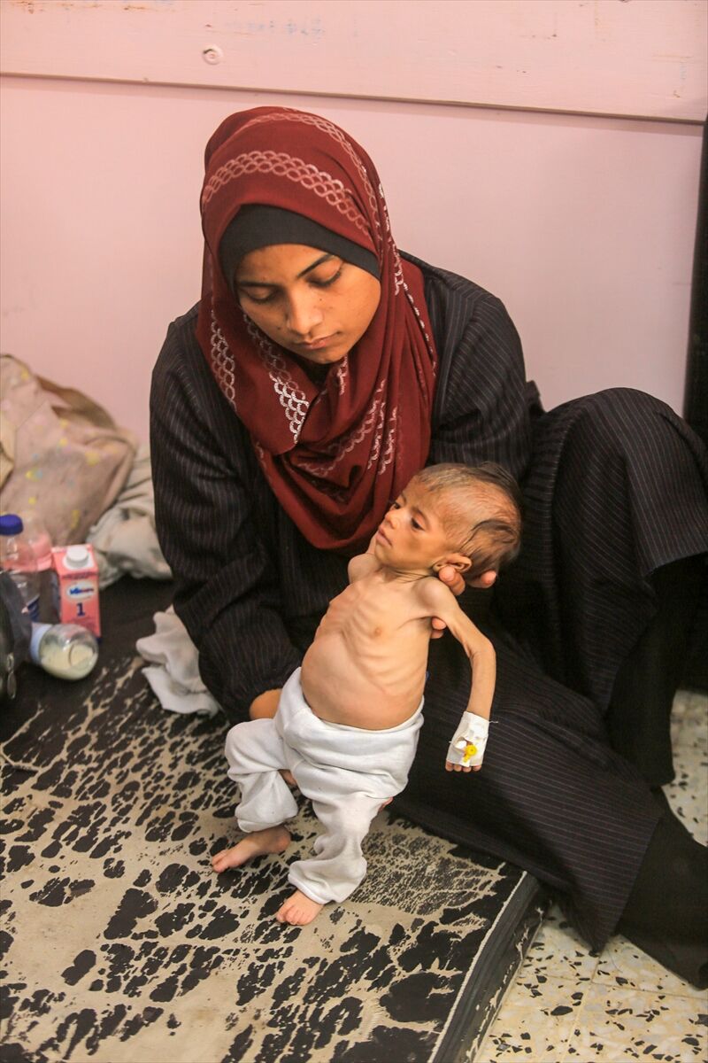 A A 20250724 38649236 38649232 K I T L E S E L A C L I K K R I Z I N I N D E R I N L E S T I G I G A Z Z E D E H A S T A N E L E R O L U M L E P E N C E L E S E N B E B E K L E R L E D O L U P T A S I Y O R