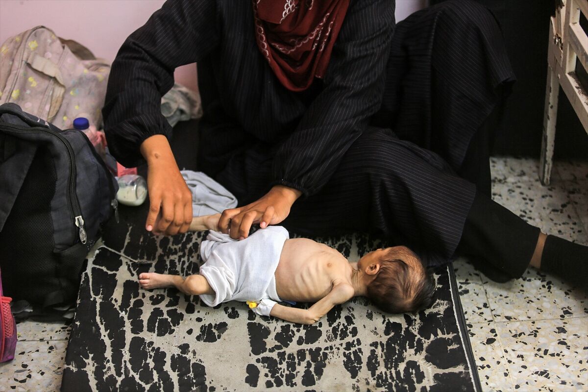 A A 20250724 38649236 38649233 K I T L E S E L A C L I K K R I Z I N I N D E R I N L E S T I G I G A Z Z E D E H A S T A N E L E R O L U M L E P E N C E L E S E N B E B E K L E R L E D O L U P T A S I Y O R