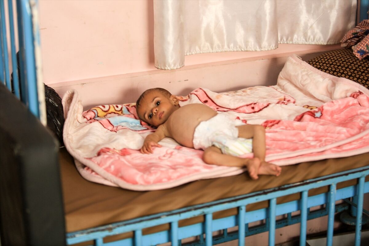 A A 20250724 38649236 38649234 K I T L E S E L A C L I K K R I Z I N I N D E R I N L E S T I G I G A Z Z E D E H A S T A N E L E R O L U M L E P E N C E L E S E N B E B E K L E R L E D O L U P T A S I Y O R