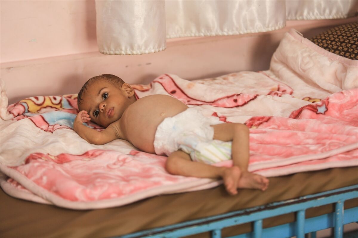 A A 20250724 38649236 38649235 K I T L E S E L A C L I K K R I Z I N I N D E R I N L E S T I G I G A Z Z E D E H A S T A N E L E R O L U M L E P E N C E L E S E N B E B E K L E R L E D O L U P T A S I Y O R