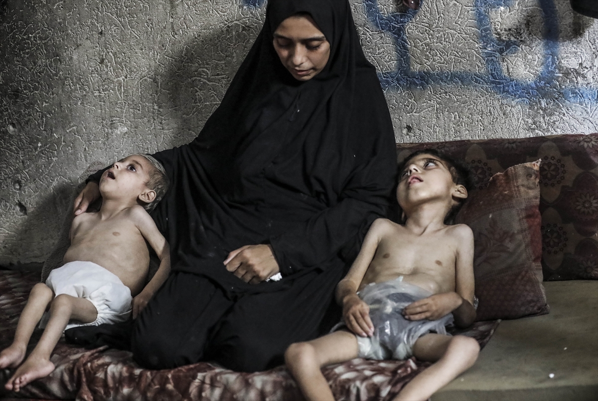 A A 20250726 38666416 38666395 G A Z Z E D E Y E T E R S I Z B E S L E N M E S O R U N U Y A S A Y A N I K I K A R D E S O L U M T E H L I K E S I Y L E K A R S I K A R S I Y A