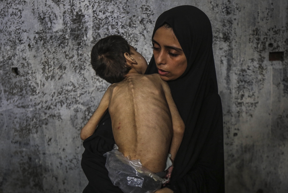 A A 20250726 38666416 38666397 G A Z Z E D E Y E T E R S I Z B E S L E N M E S O R U N U Y A S A Y A N I K I K A R D E S O L U M T E H L I K E S I Y L E K A R S I K A R S I Y A