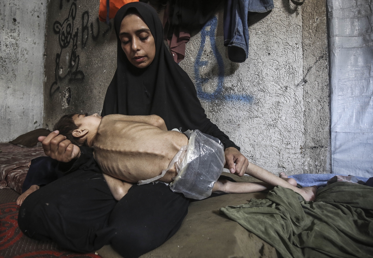 A A 20250726 38666416 38666398 G A Z Z E D E Y E T E R S I Z B E S L E N M E S O R U N U Y A S A Y A N I K I K A R D E S O L U M T E H L I K E S I Y L E K A R S I K A R S I Y A