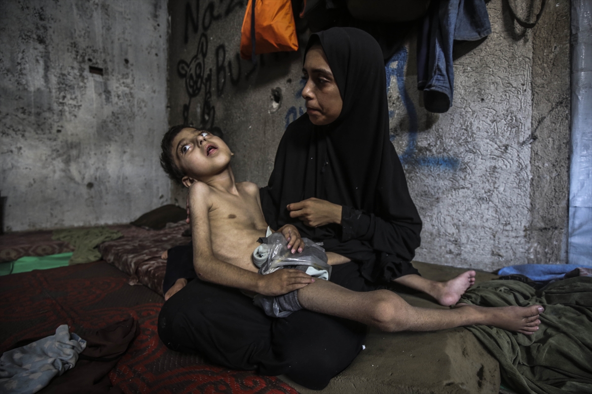 A A 20250726 38666416 38666399 G A Z Z E D E Y E T E R S I Z B E S L E N M E S O R U N U Y A S A Y A N I K I K A R D E S O L U M T E H L I K E S I Y L E K A R S I K A R S I Y A