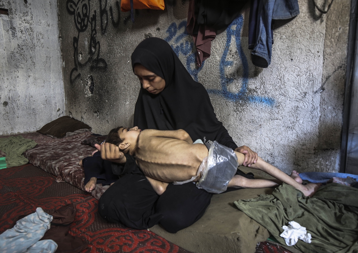 A A 20250726 38666416 38666400 G A Z Z E D E Y E T E R S I Z B E S L E N M E S O R U N U Y A S A Y A N I K I K A R D E S O L U M T E H L I K E S I Y L E K A R S I K A R S I Y A