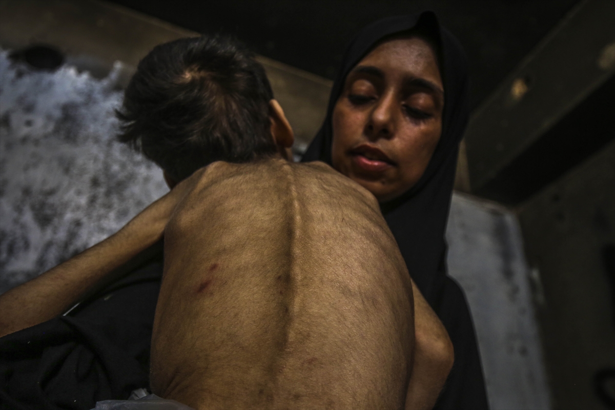 A A 20250726 38666416 38666403 G A Z Z E D E Y E T E R S I Z B E S L E N M E S O R U N U Y A S A Y A N I K I K A R D E S O L U M T E H L I K E S I Y L E K A R S I K A R S I Y A