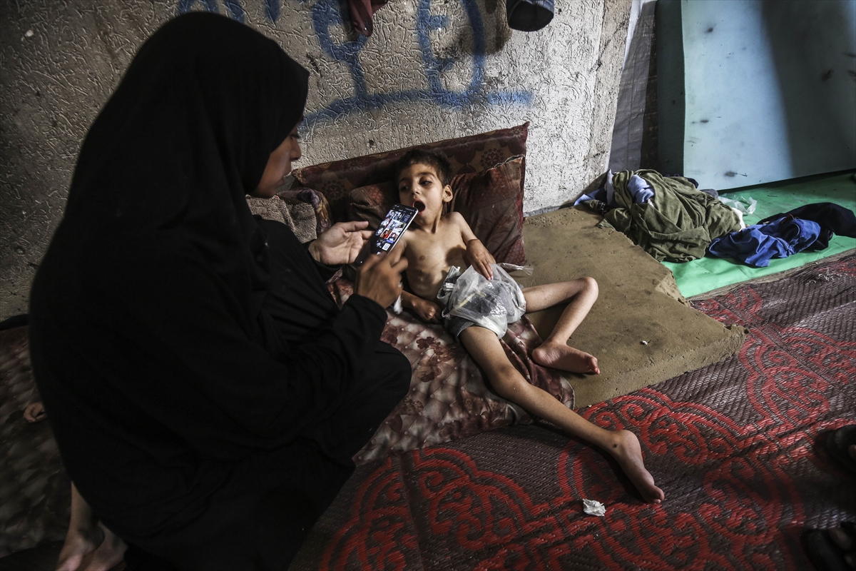 A A 20250726 38666416 38666404 G A Z Z E D E Y E T E R S I Z B E S L E N M E S O R U N U Y A S A Y A N I K I K A R D E S O L U M T E H L I K E S I Y L E K A R S I K A R S I Y A