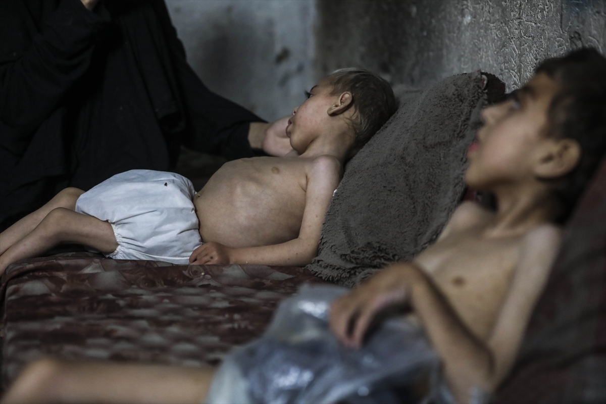 A A 20250726 38666416 38666406 G A Z Z E D E Y E T E R S I Z B E S L E N M E S O R U N U Y A S A Y A N I K I K A R D E S O L U M T E H L I K E S I Y L E K A R S I K A R S I Y A