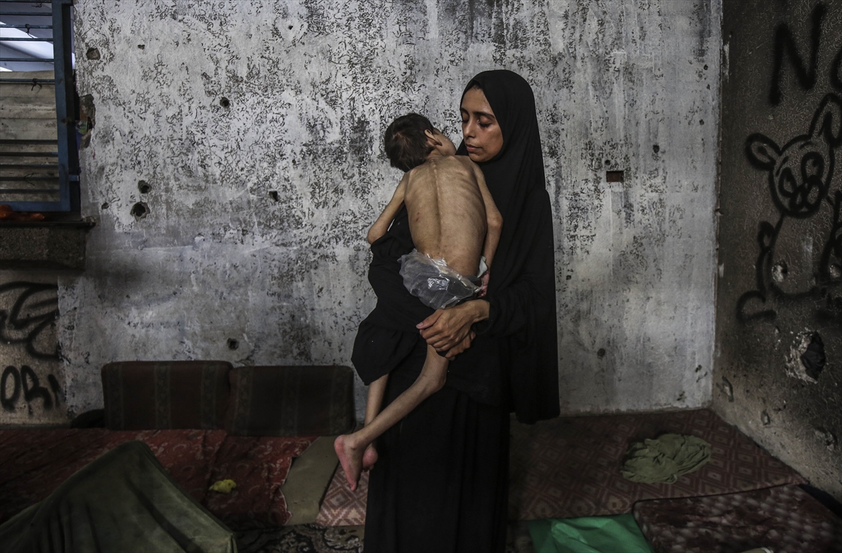 A A 20250726 38666416 38666409 G A Z Z E D E Y E T E R S I Z B E S L E N M E S O R U N U Y A S A Y A N I K I K A R D E S O L U M T E H L I K E S I Y L E K A R S I K A R S I Y A