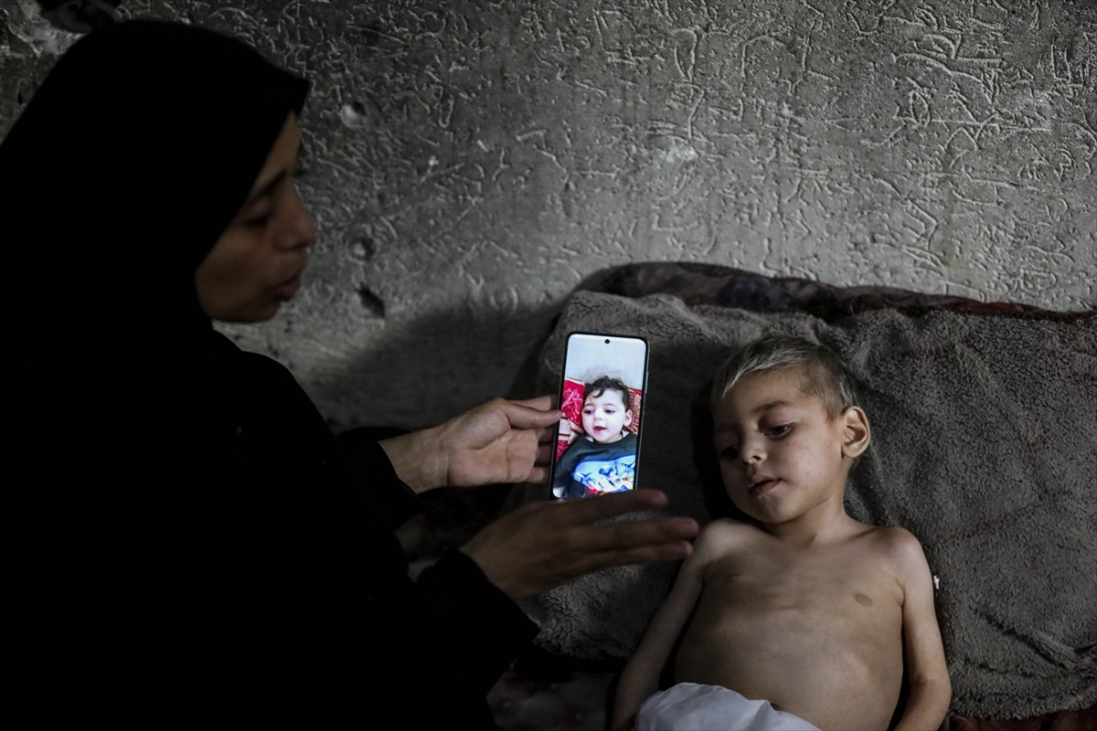 A A 20250726 38666416 38666411 G A Z Z E D E Y E T E R S I Z B E S L E N M E S O R U N U Y A S A Y A N I K I K A R D E S O L U M T E H L I K E S I Y L E K A R S I K A R S I Y A