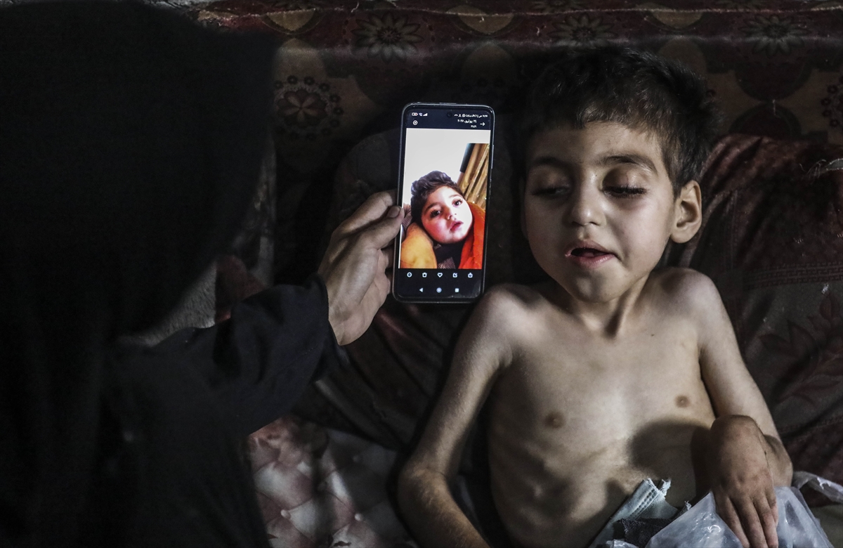 A A 20250726 38666416 38666412 G A Z Z E D E Y E T E R S I Z B E S L E N M E S O R U N U Y A S A Y A N I K I K A R D E S O L U M T E H L I K E S I Y L E K A R S I K A R S I Y A