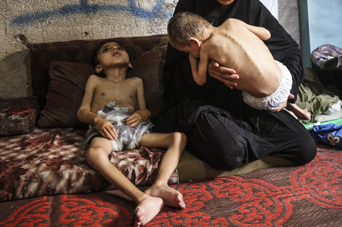 A A 20250726 38666416 38666414 G A Z Z E D E Y E T E R S I Z B E S L E N M E S O R U N U Y A S A Y A N I K I K A R D E S O L U M T E H L I K E S I Y L E K A R S I K A R S I Y A