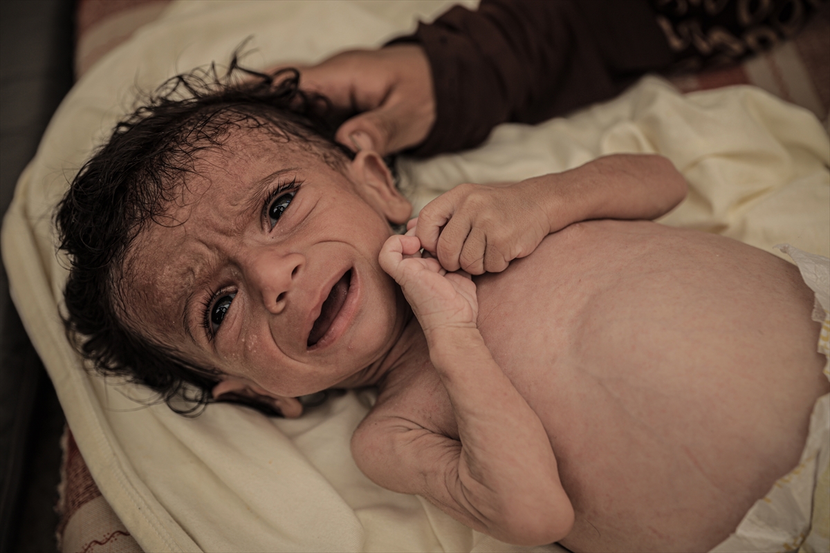 A A 20250727 38675560 38675543 I S R A I L I N K I T L I G A S U R U K L E D I G I G A Z Z E D E 7 A Y L I K B E B E G I N Y A S A M I T E H L I K E A L T I N D A