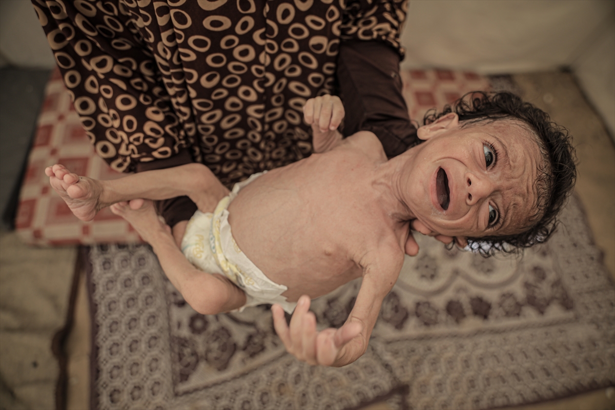 A A 20250727 38675560 38675558 I S R A I L I N K I T L I G A S U R U K L E D I G I G A Z Z E D E 7 A Y L I K B E B E G I N Y A S A M I T E H L I K E A L T I N D A