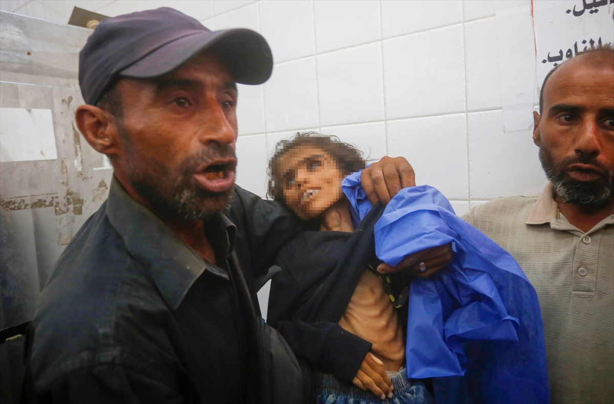 A A 20250727 38676398 38676366 G A Z Z E D E 10 Y A S I N D A K I N U R E B U S E L A Y E T E R S I Z B E S L E N M E N E D E N I Y L E H A Y A T I N I K A Y B E T T I