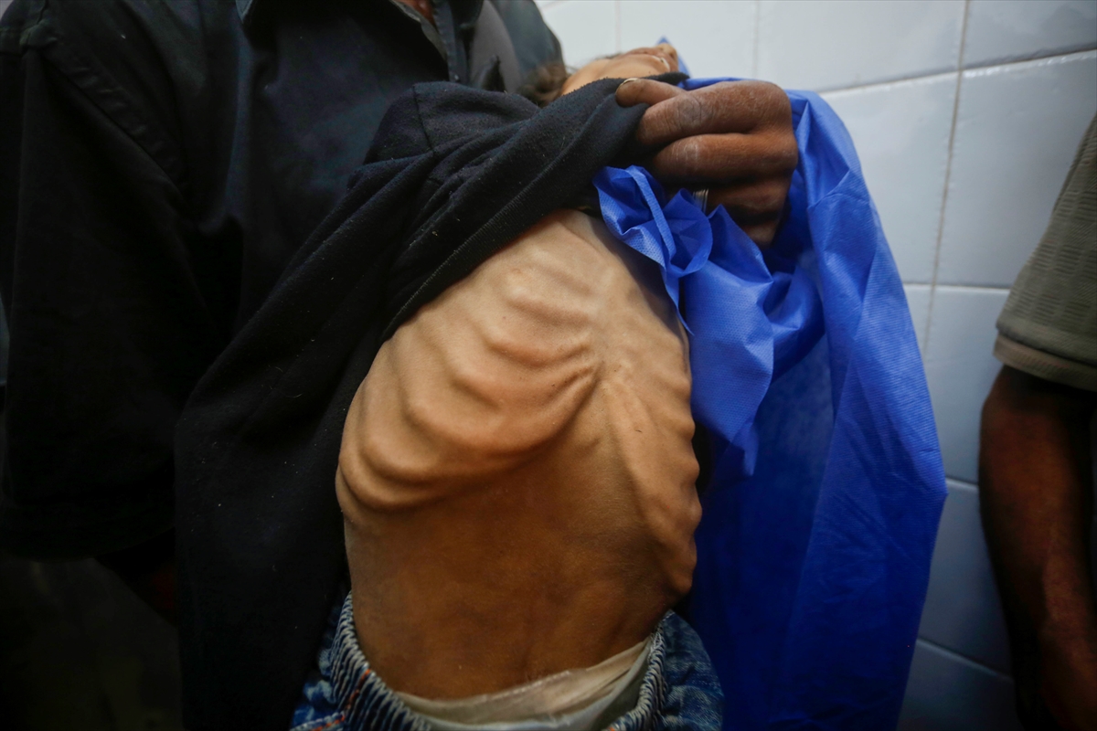 A A 20250727 38676398 38676372 G A Z Z E D E 10 Y A S I N D A K I N U R E B U S E L A Y E T E R S I Z B E S L E N M E N E D E N I Y L E H A Y A T I N I K A Y B E T T I