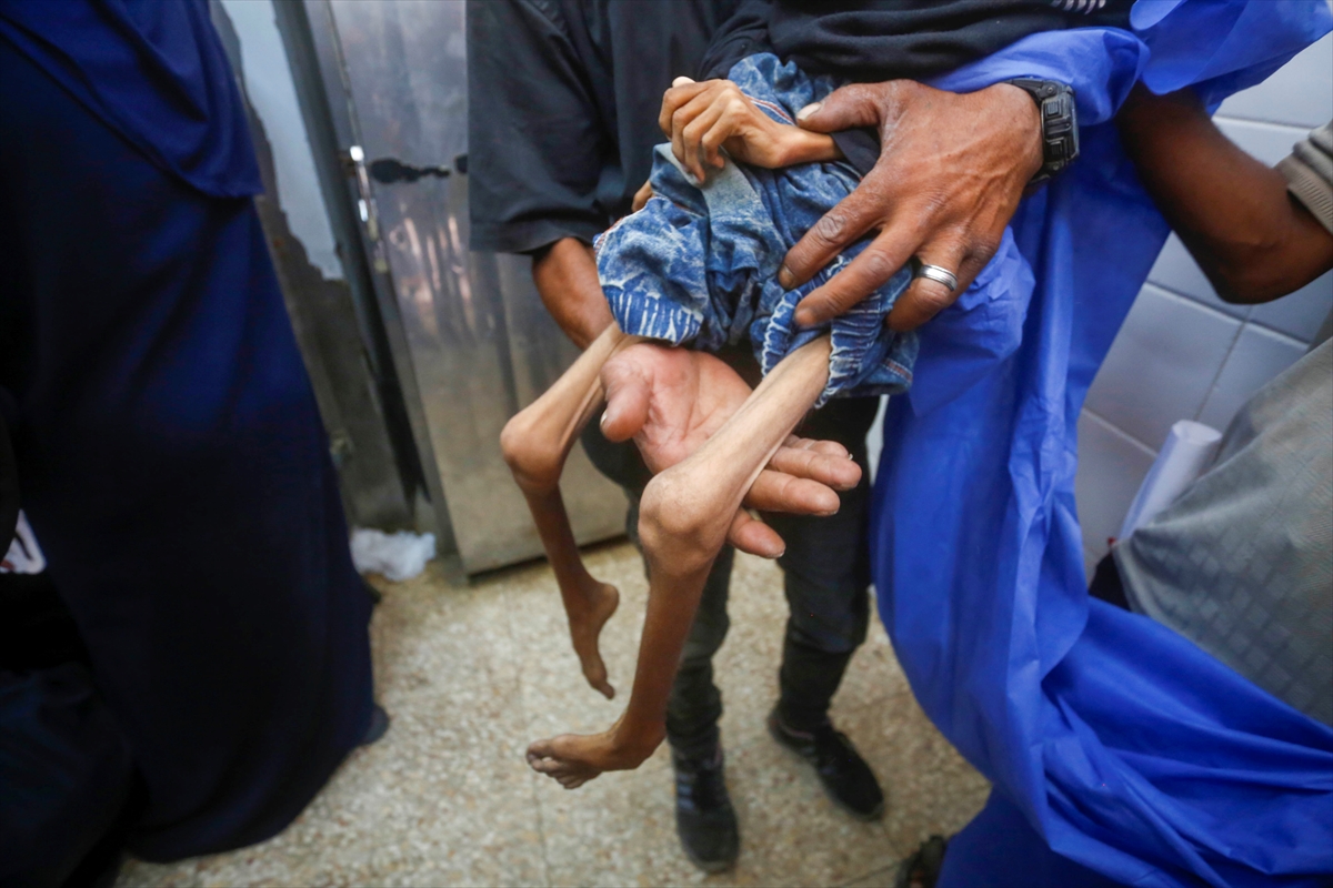 A A 20250727 38676398 38676374 G A Z Z E D E 10 Y A S I N D A K I N U R E B U S E L A Y E T E R S I Z B E S L E N M E N E D E N I Y L E H A Y A T I N I K A Y B E T T I