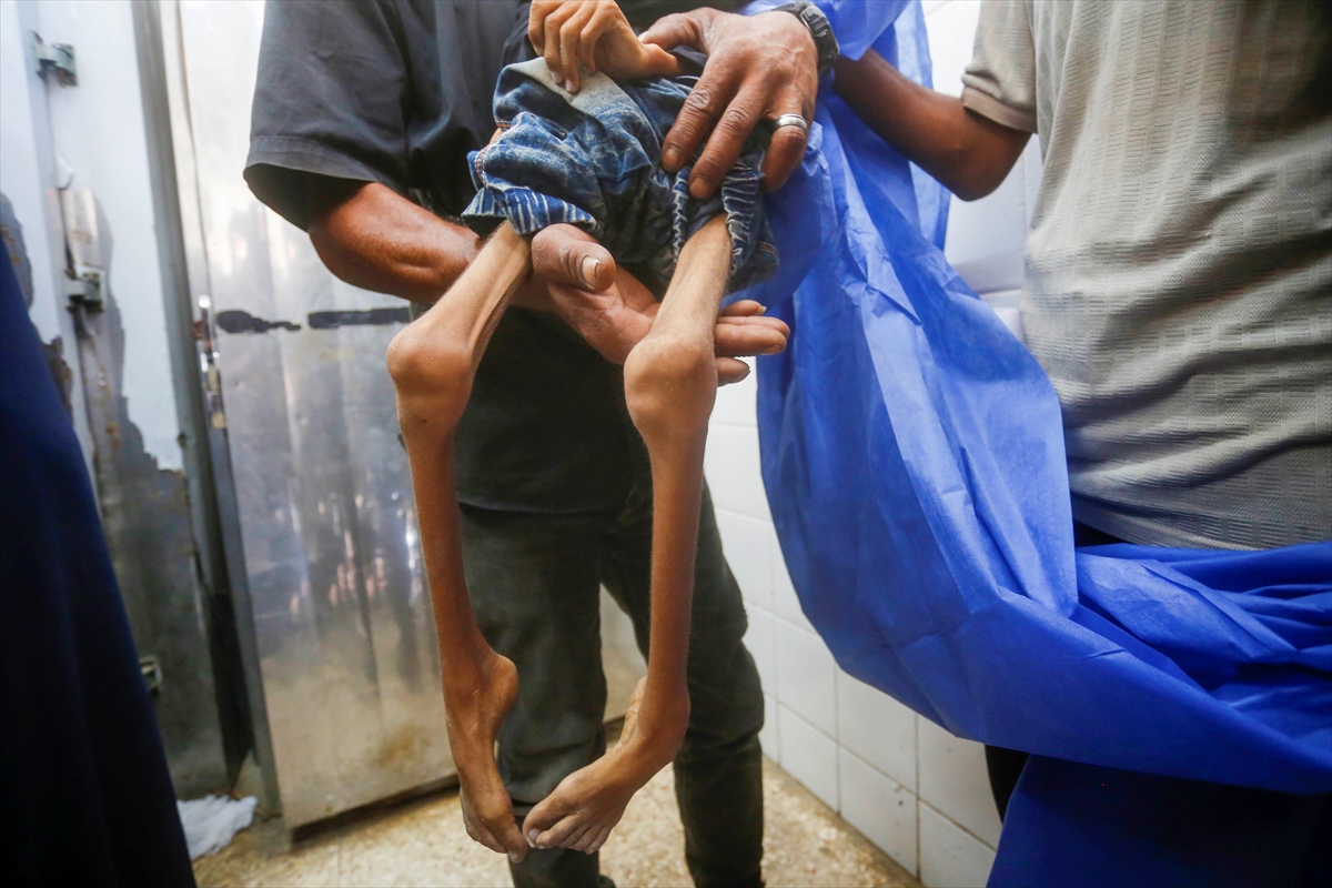 A A 20250727 38676398 38676376 G A Z Z E D E 10 Y A S I N D A K I N U R E B U S E L A Y E T E R S I Z B E S L E N M E N E D E N I Y L E H A Y A T I N I K A Y B E T T I