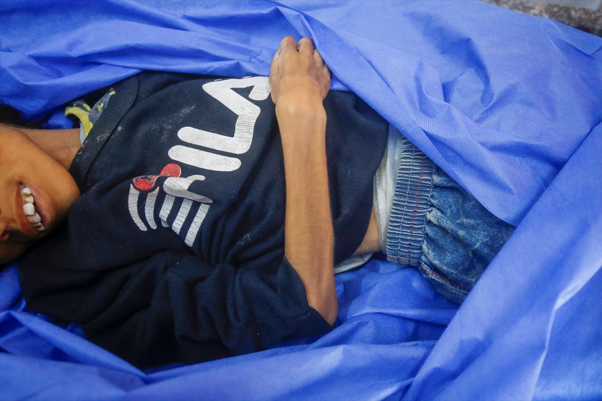 A A 20250727 38676398 38676397 G A Z Z E D E 10 Y A S I N D A K I N U R E B U S E L A Y E T E R S I Z B E S L E N M E N E D E N I Y L E H A Y A T I N I K A Y B E T T I