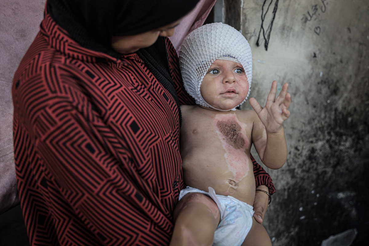 A A 20250817 38850142 38850117 G A Z Z E D E U C U N C U D E R E C E Y A N I K L A R L A Y A R A L A N A N M U H A M M E D Y A R D I M B E K L I Y O R