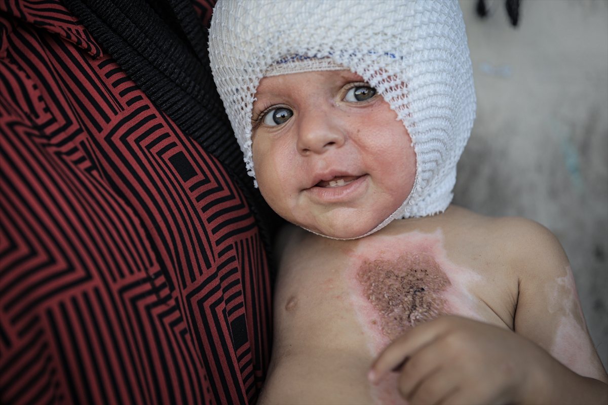 A A 20250817 38850142 38850119 G A Z Z E D E U C U N C U D E R E C E Y A N I K L A R L A Y A R A L A N A N M U H A M M E D Y A R D I M B E K L I Y O R