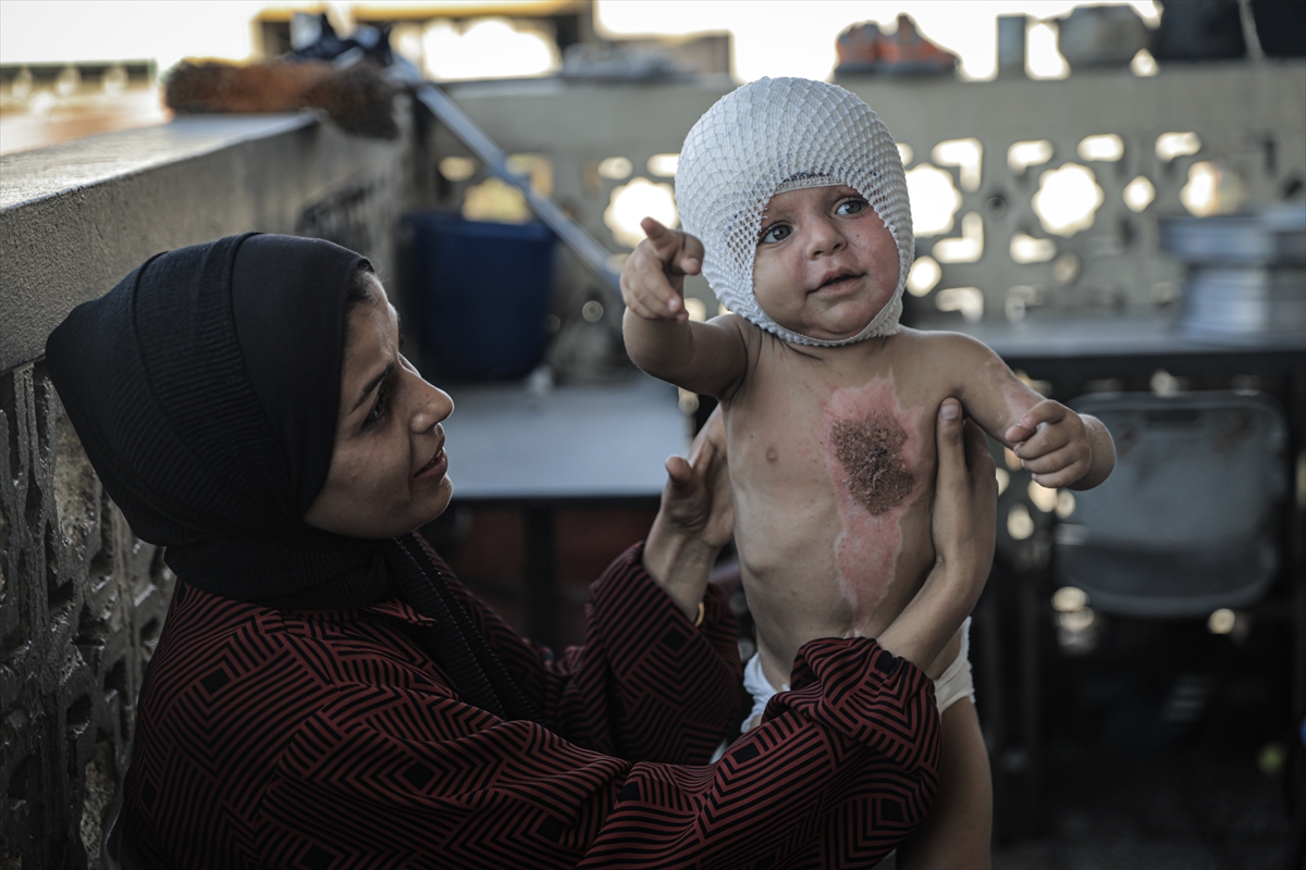 A A 20250817 38850142 38850120 G A Z Z E D E U C U N C U D E R E C E Y A N I K L A R L A Y A R A L A N A N M U H A M M E D Y A R D I M B E K L I Y O R