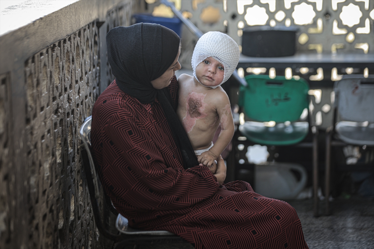 A A 20250817 38850142 38850124 G A Z Z E D E U C U N C U D E R E C E Y A N I K L A R L A Y A R A L A N A N M U H A M M E D Y A R D I M B E K L I Y O R