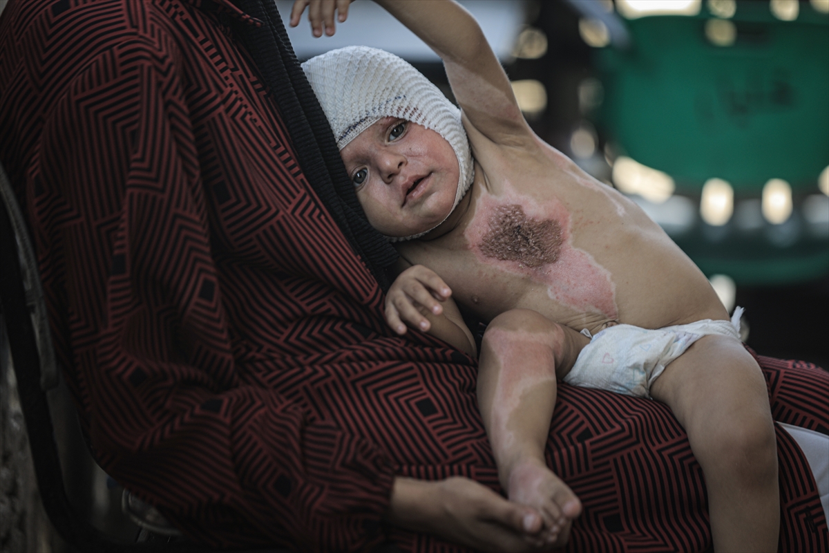 A A 20250817 38850142 38850126 G A Z Z E D E U C U N C U D E R E C E Y A N I K L A R L A Y A R A L A N A N M U H A M M E D Y A R D I M B E K L I Y O R