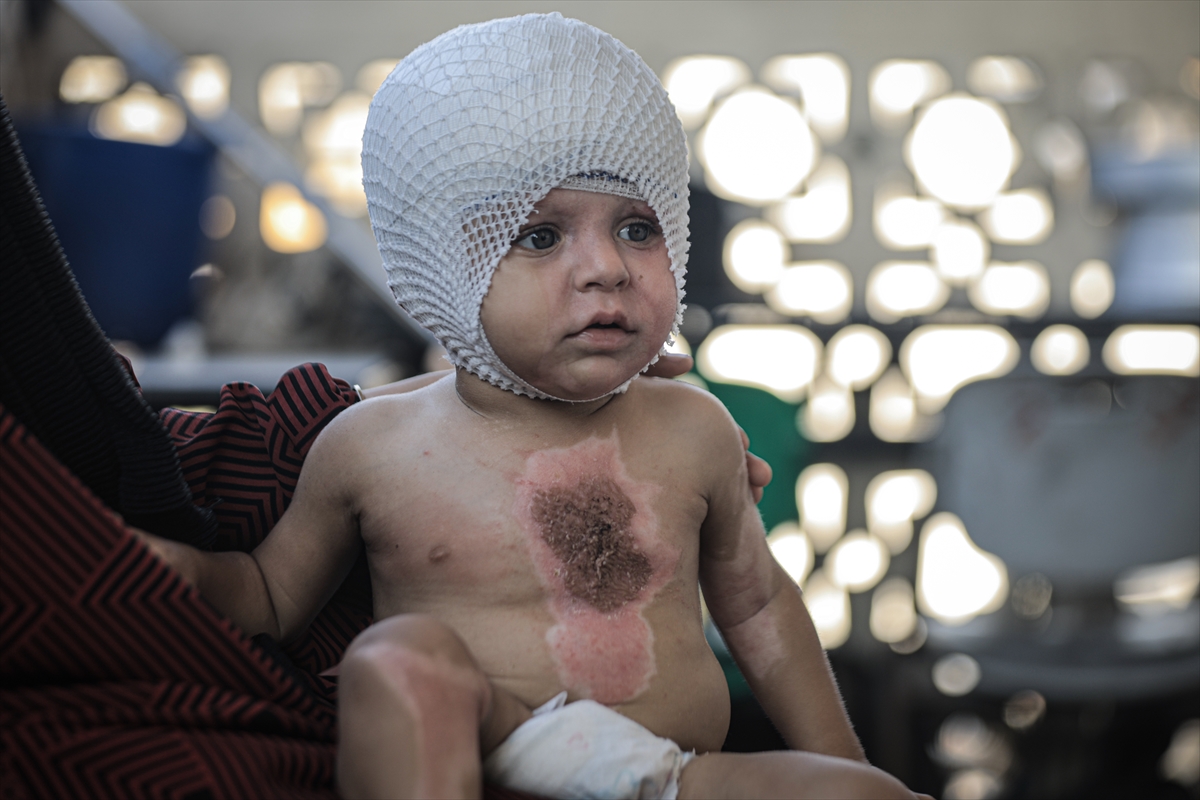 A A 20250817 38850142 38850127 G A Z Z E D E U C U N C U D E R E C E Y A N I K L A R L A Y A R A L A N A N M U H A M M E D Y A R D I M B E K L I Y O R