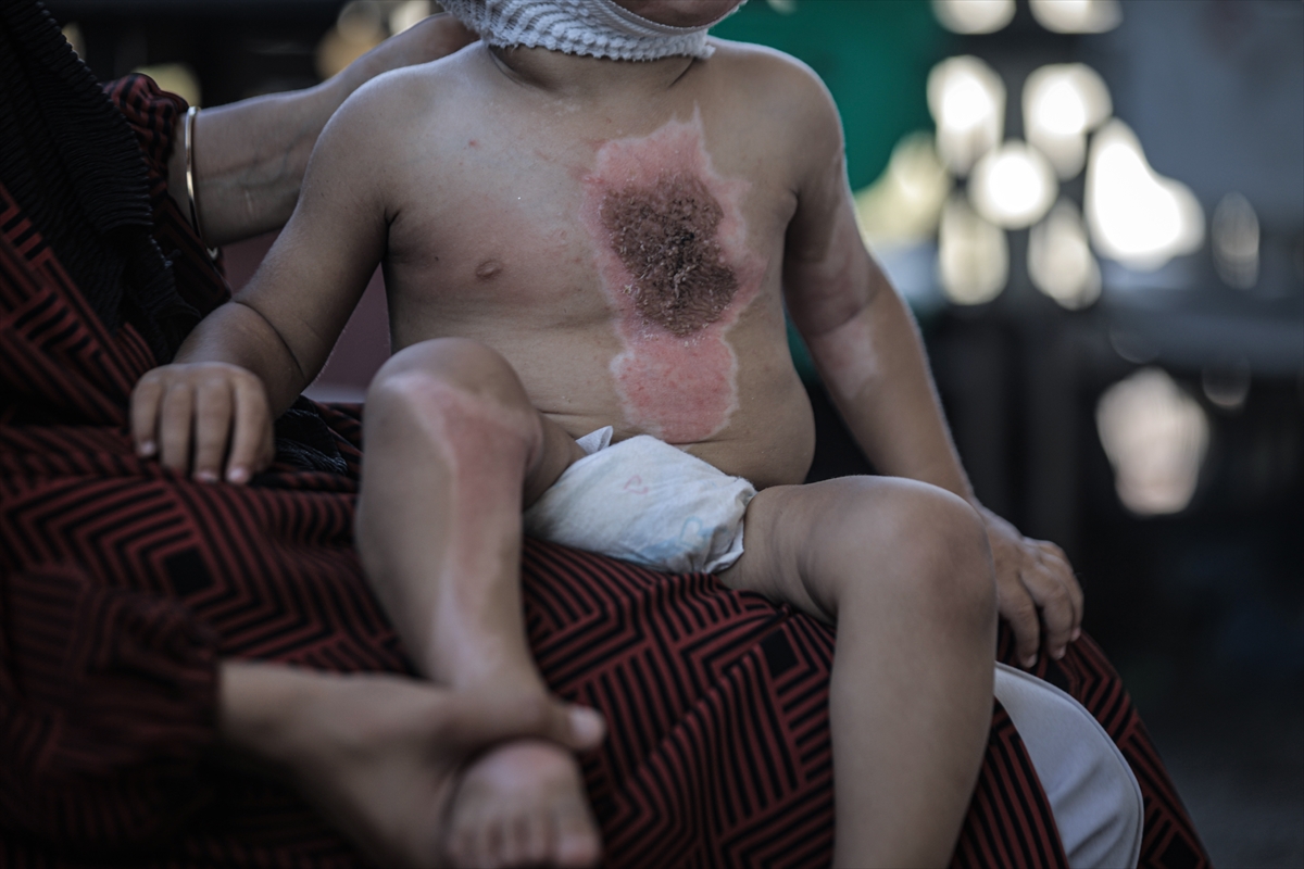 A A 20250817 38850142 38850128 G A Z Z E D E U C U N C U D E R E C E Y A N I K L A R L A Y A R A L A N A N M U H A M M E D Y A R D I M B E K L I Y O R