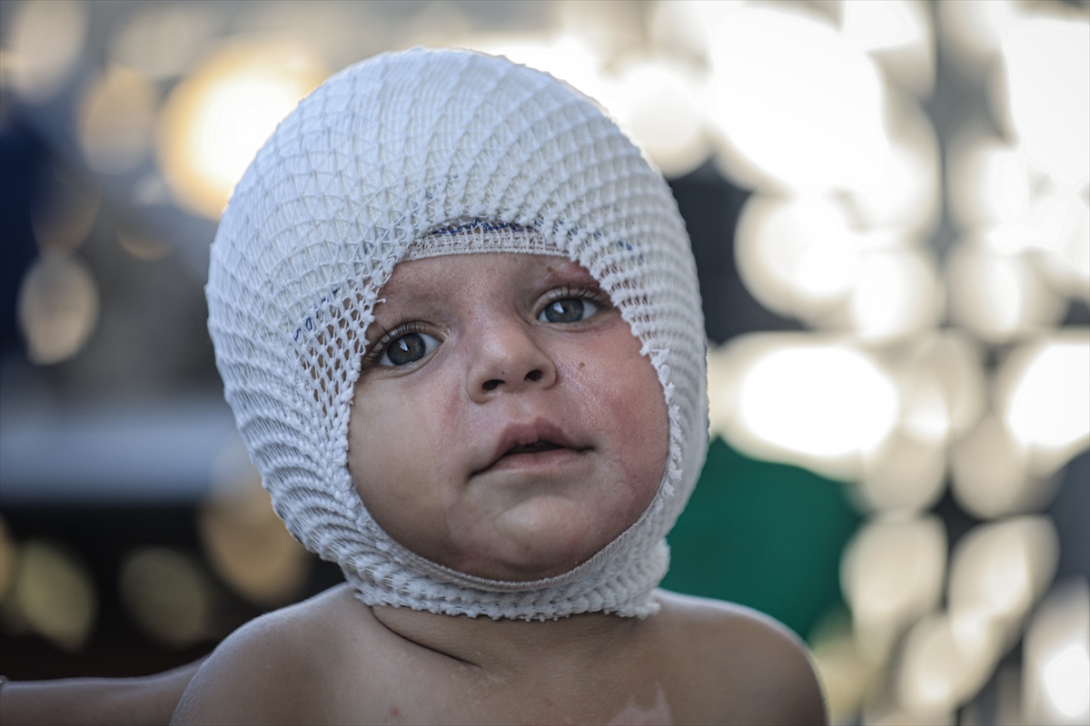 A A 20250817 38850142 38850131 G A Z Z E D E U C U N C U D E R E C E Y A N I K L A R L A Y A R A L A N A N M U H A M M E D Y A R D I M B E K L I Y O R