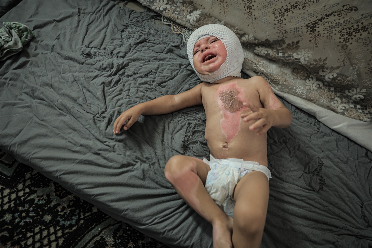 A A 20250817 38850142 38850138 G A Z Z E D E U C U N C U D E R E C E Y A N I K L A R L A Y A R A L A N A N M U H A M M E D Y A R D I M B E K L I Y O R