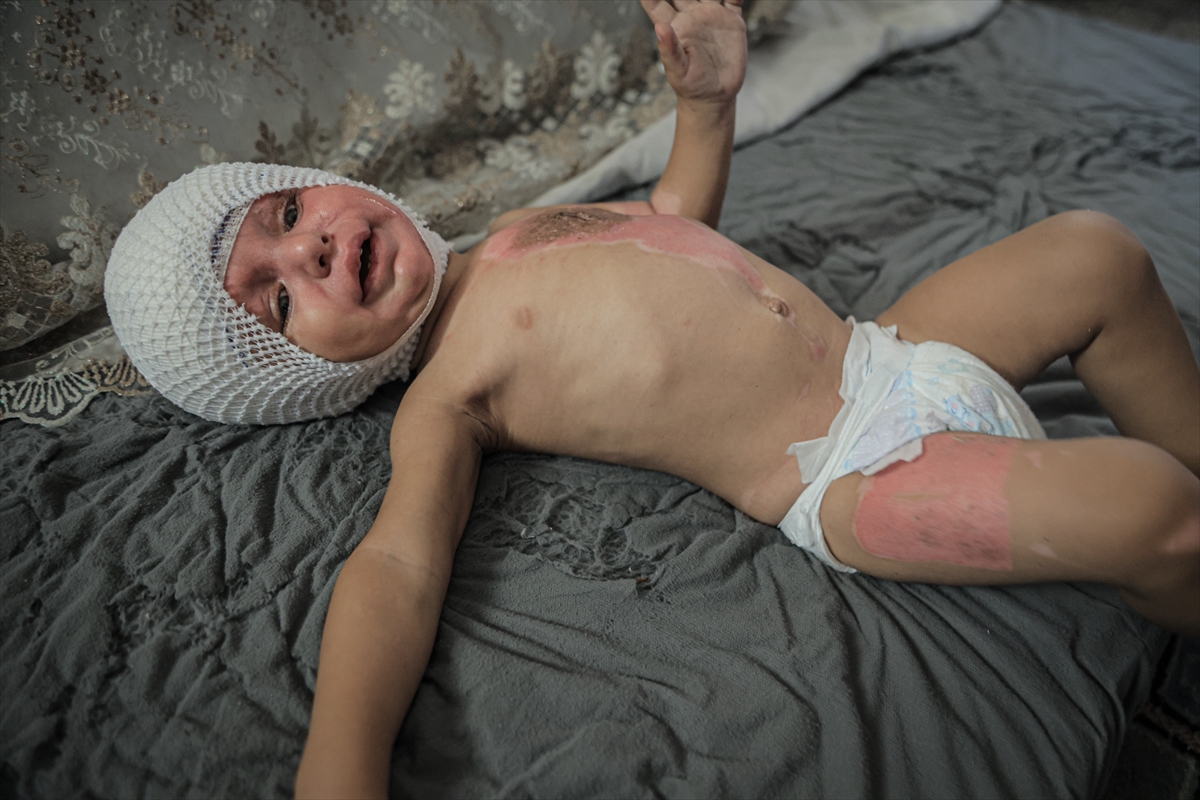 A A 20250817 38850142 38850139 G A Z Z E D E U C U N C U D E R E C E Y A N I K L A R L A Y A R A L A N A N M U H A M M E D Y A R D I M B E K L I Y O R