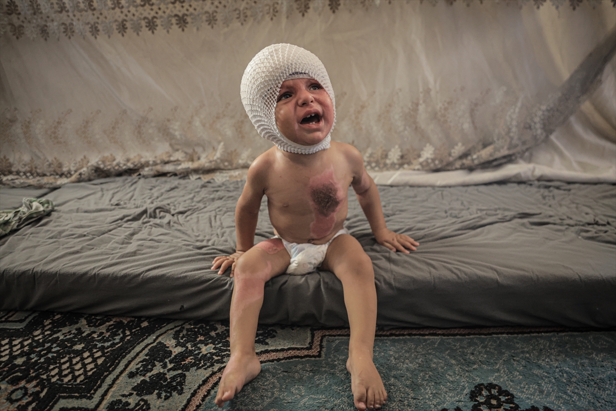 A A 20250817 38850142 38850140 G A Z Z E D E U C U N C U D E R E C E Y A N I K L A R L A Y A R A L A N A N M U H A M M E D Y A R D I M B E K L I Y O R