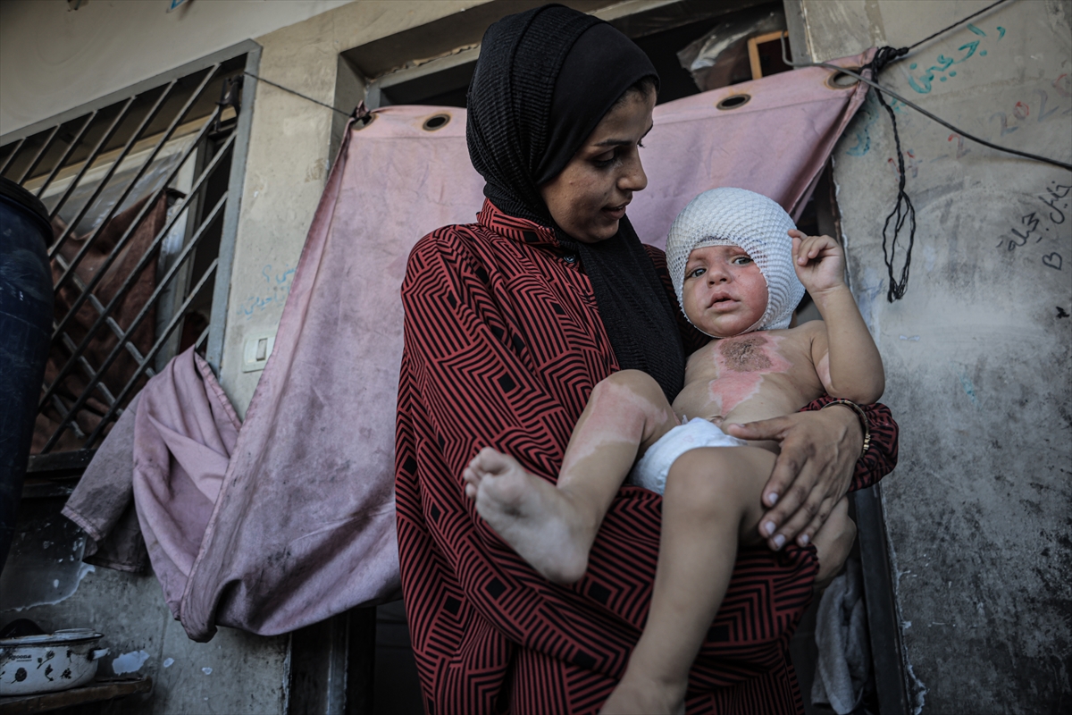 A A 20250817 38850142 38850141 G A Z Z E D E U C U N C U D E R E C E Y A N I K L A R L A Y A R A L A N A N M U H A M M E D Y A R D I M B E K L I Y O R