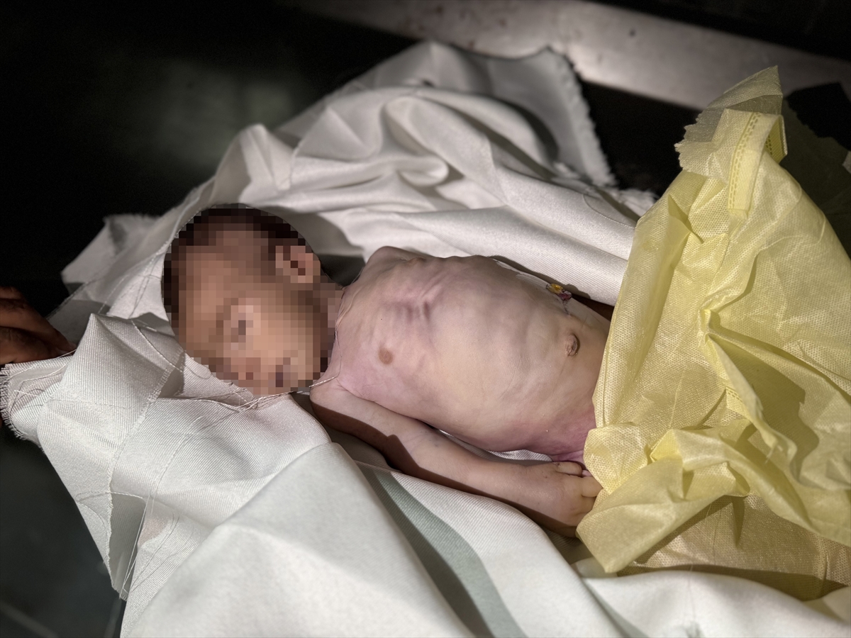 A A 20250907 39044827 39044817 G A Z Z E D E 25 A Y L I K M U H A M M E D M A Z E N E L K A R A Y A S A M I N I Y I T I R D I