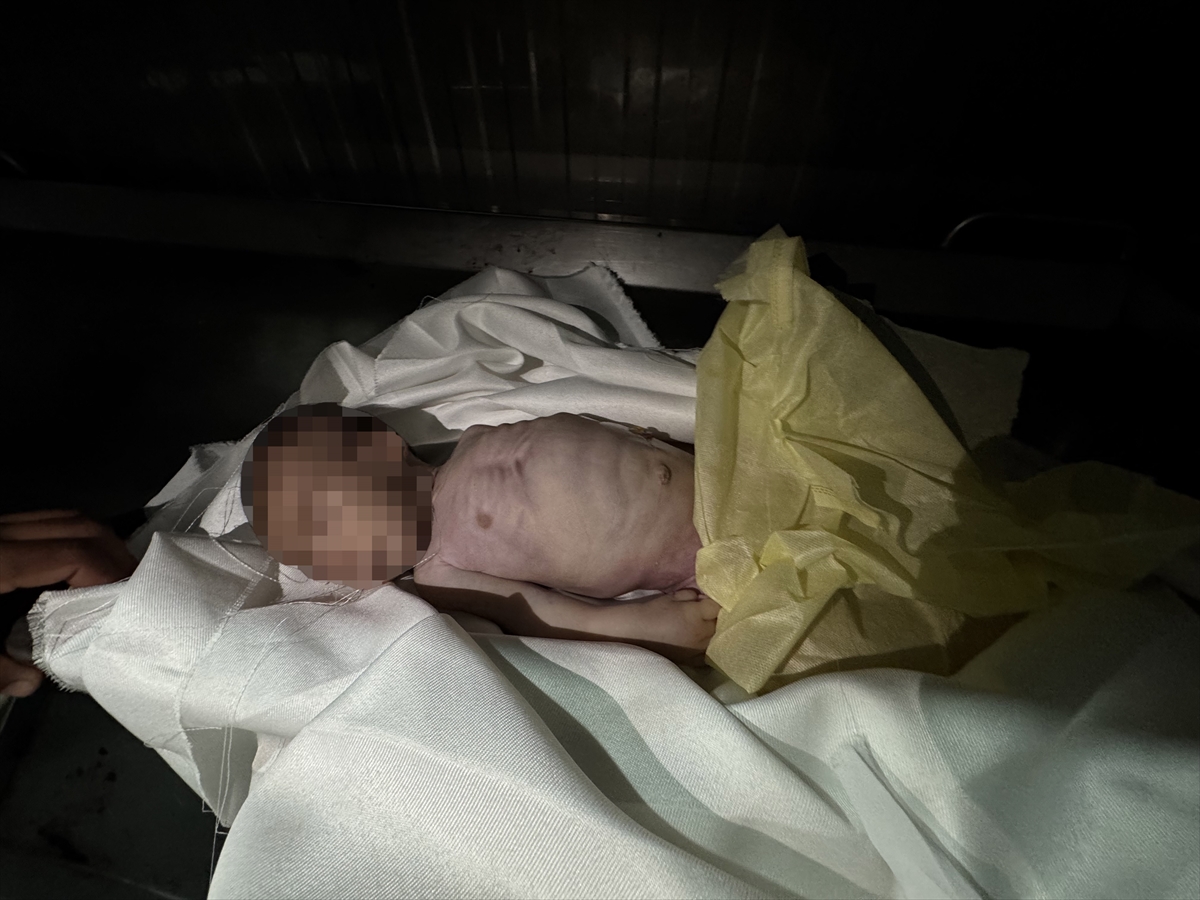 A A 20250907 39044827 39044818 G A Z Z E D E 25 A Y L I K M U H A M M E D M A Z E N E L K A R A Y A S A M I N I Y I T I R D I