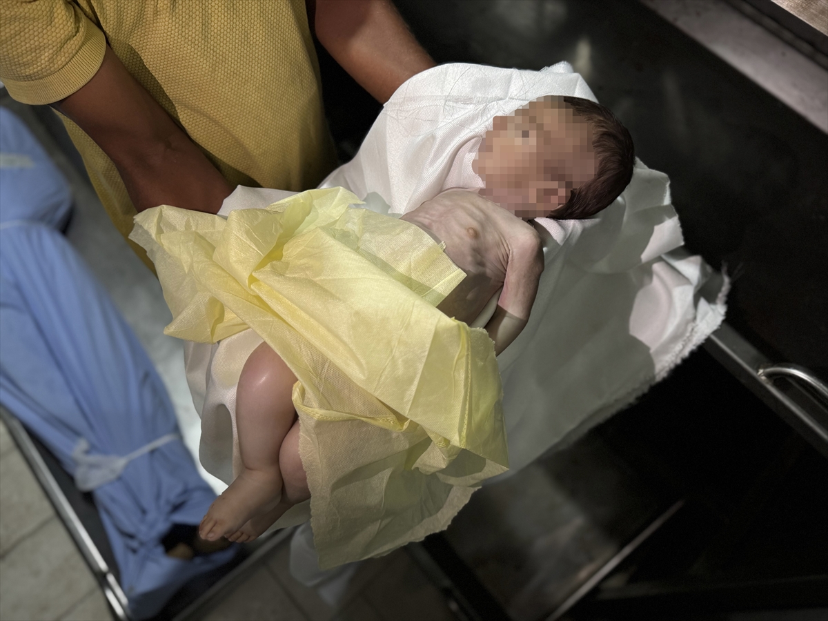 A A 20250907 39044827 39044821 G A Z Z E D E 25 A Y L I K M U H A M M E D M A Z E N E L K A R A Y A S A M I N I Y I T I R D I