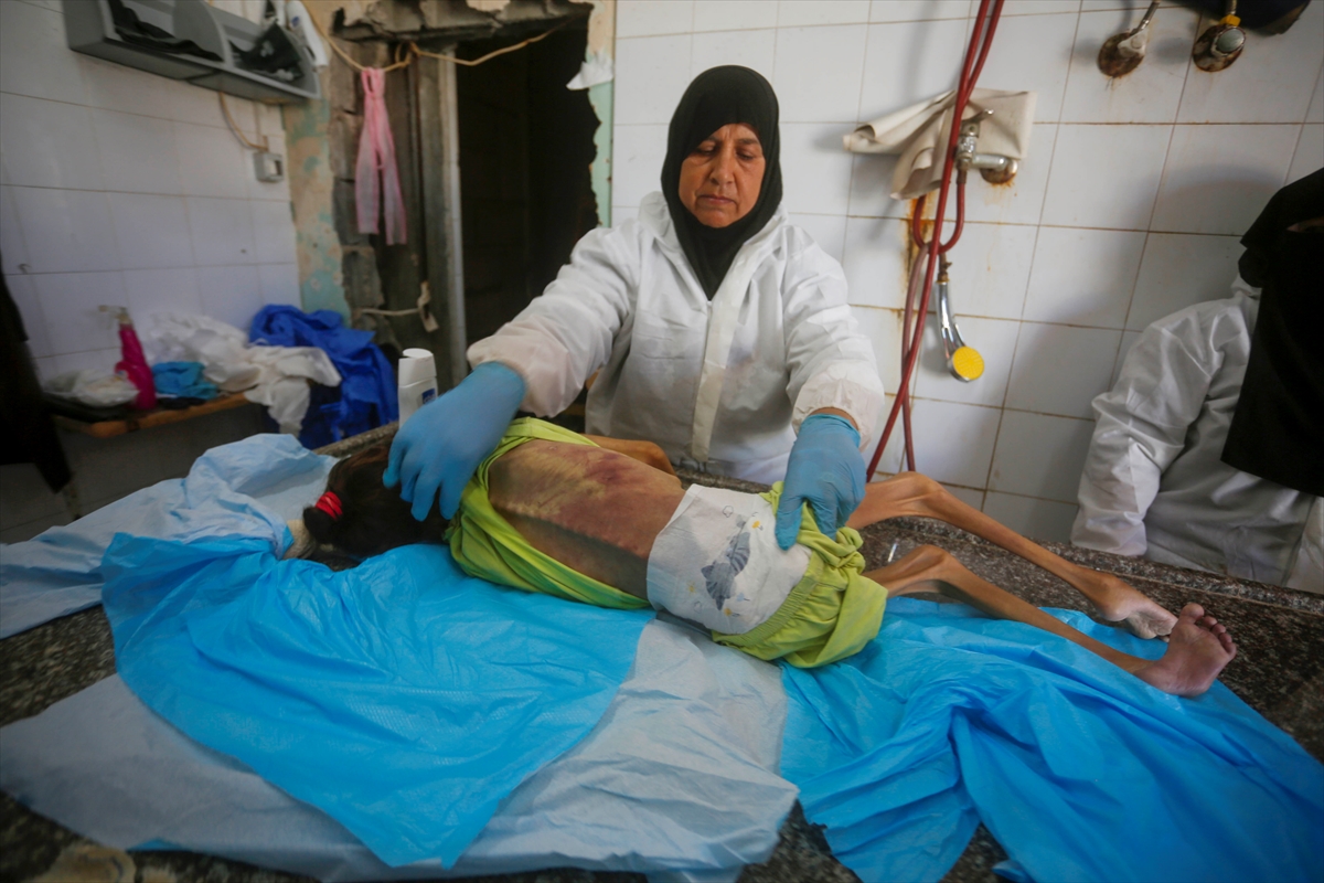 A A 20250912 39093338 39093322 G A Z Z E D E Y E T E R S I Z B E S L E N M E N E D E N I Y L E 10 Y A S I N D A K I A M I N E H A Y A T I N I K A Y B E T T I