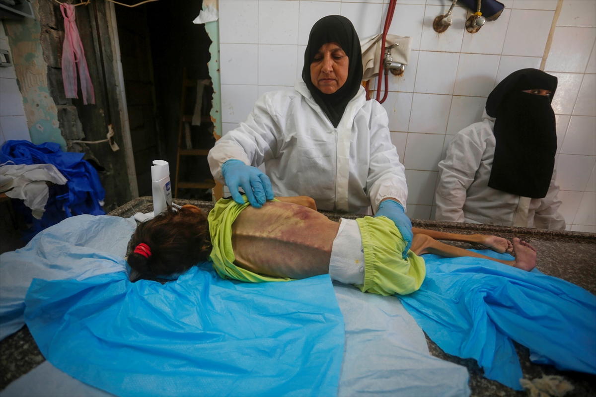 A A 20250912 39093338 39093324 G A Z Z E D E Y E T E R S I Z B E S L E N M E N E D E N I Y L E 10 Y A S I N D A K I A M I N E H A Y A T I N I K A Y B E T T I