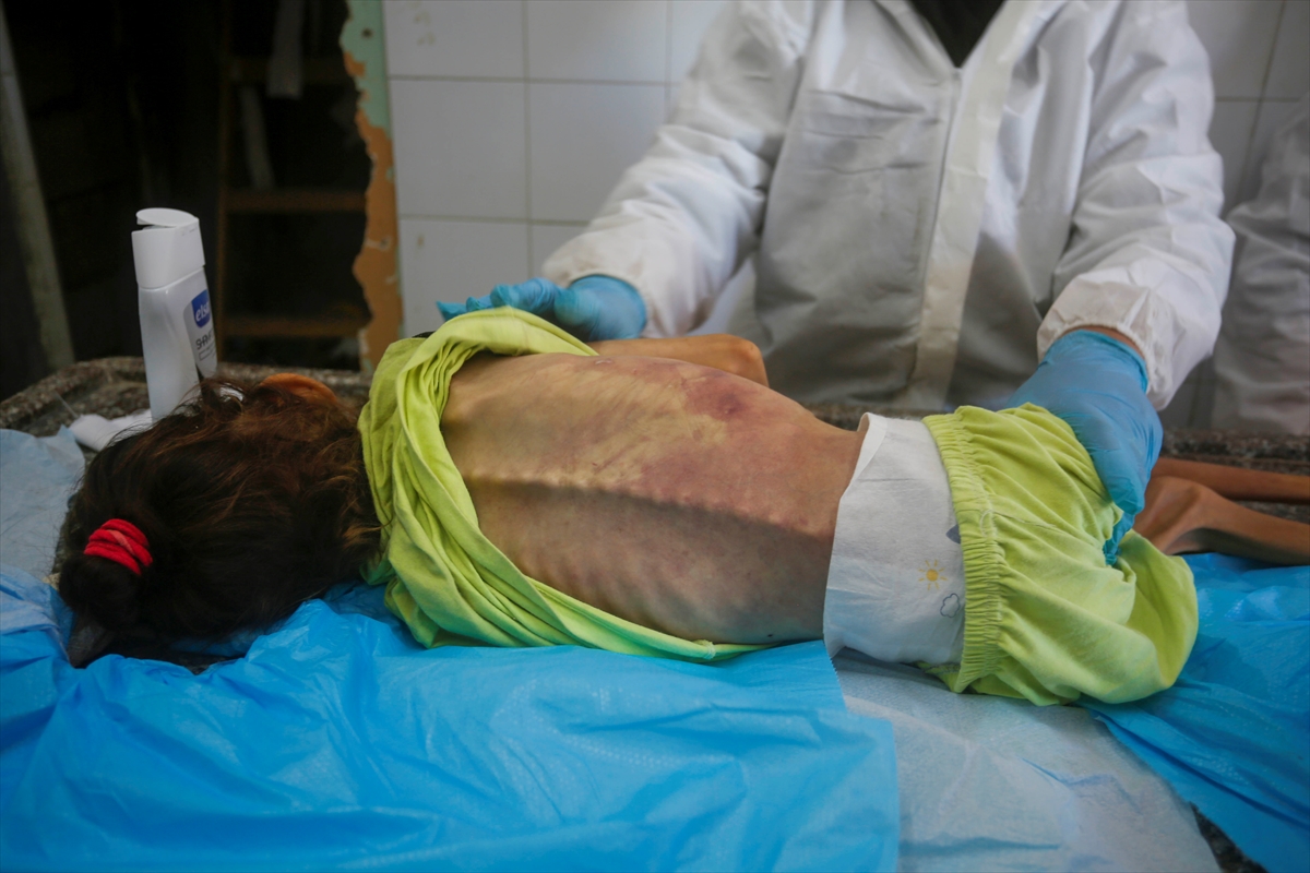 A A 20250912 39093338 39093326 G A Z Z E D E Y E T E R S I Z B E S L E N M E N E D E N I Y L E 10 Y A S I N D A K I A M I N E H A Y A T I N I K A Y B E T T I