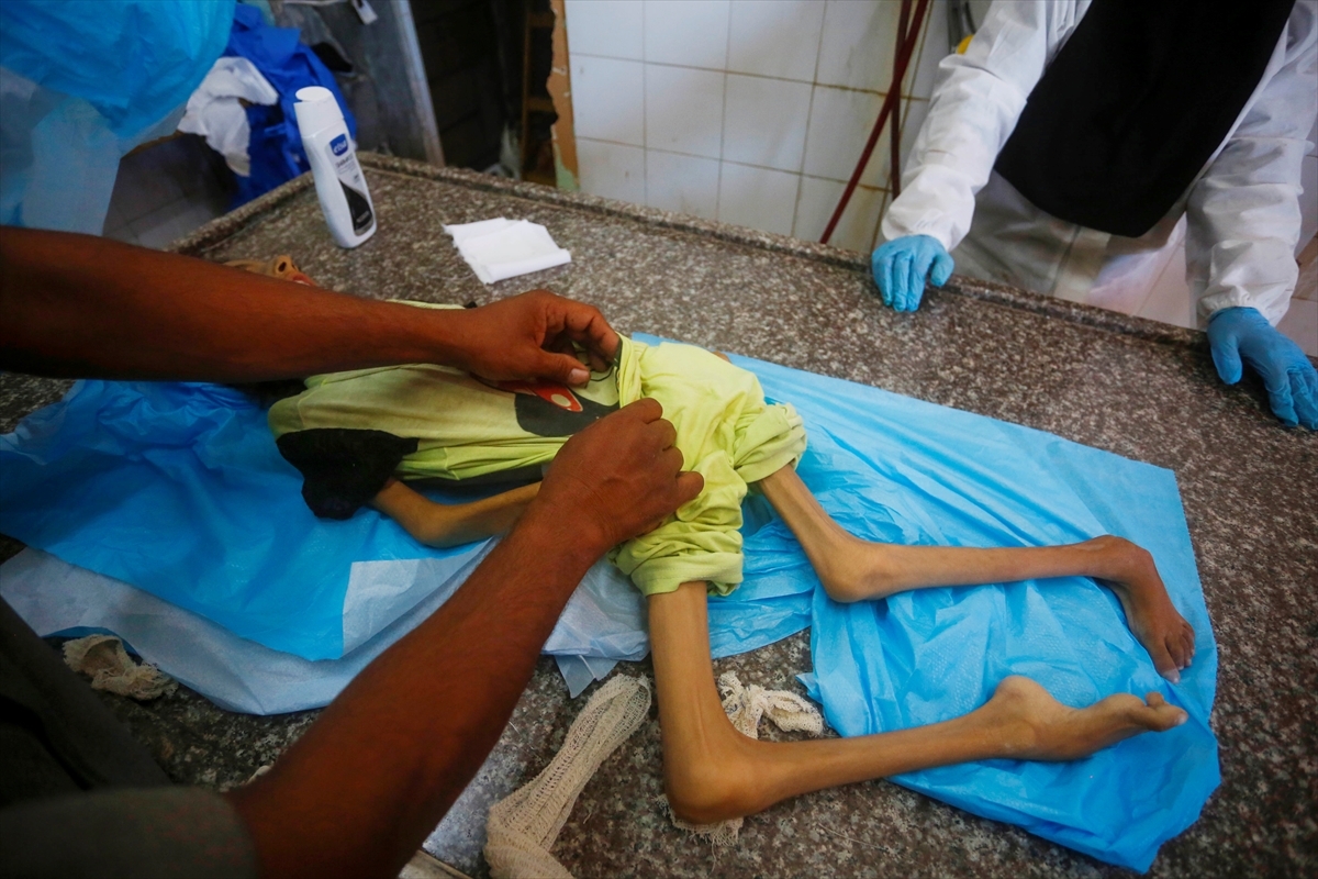 A A 20250912 39093338 39093328 G A Z Z E D E Y E T E R S I Z B E S L E N M E N E D E N I Y L E 10 Y A S I N D A K I A M I N E H A Y A T I N I K A Y B E T T I