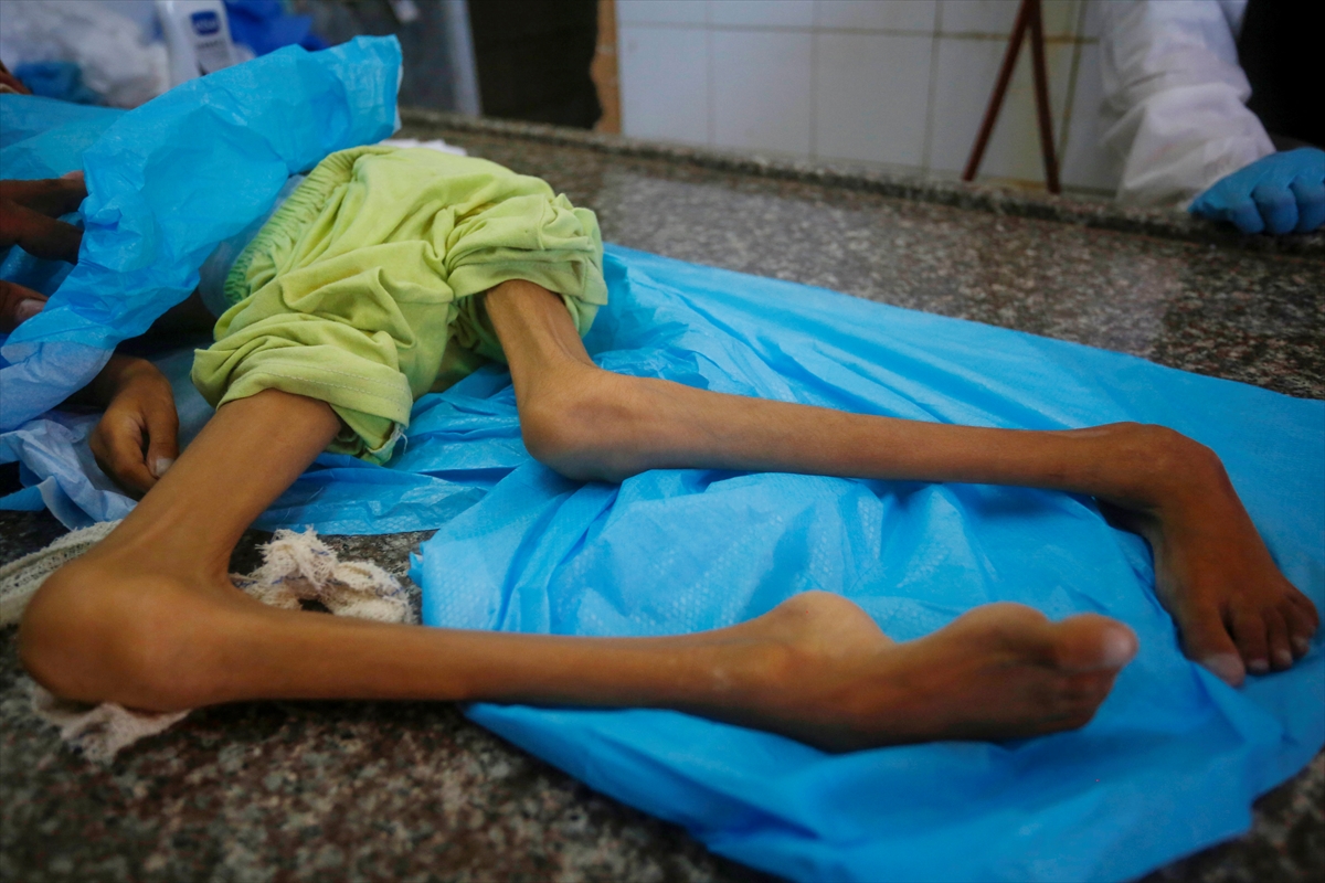 A A 20250912 39093338 39093329 G A Z Z E D E Y E T E R S I Z B E S L E N M E N E D E N I Y L E 10 Y A S I N D A K I A M I N E H A Y A T I N I K A Y B E T T I