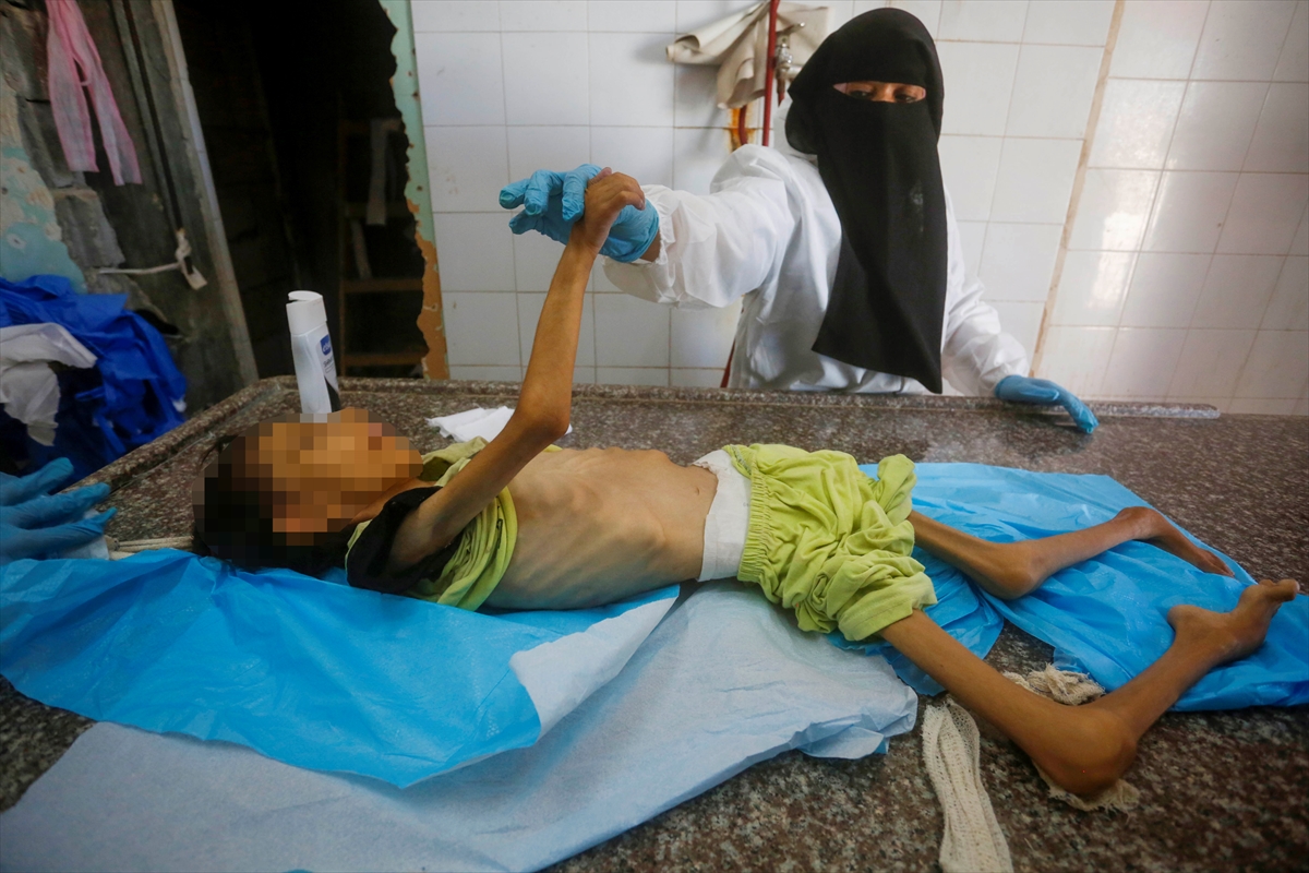 A A 20250912 39093338 39093332 G A Z Z E D E Y E T E R S I Z B E S L E N M E N E D E N I Y L E 10 Y A S I N D A K I A M I N E H A Y A T I N I K A Y B E T T I