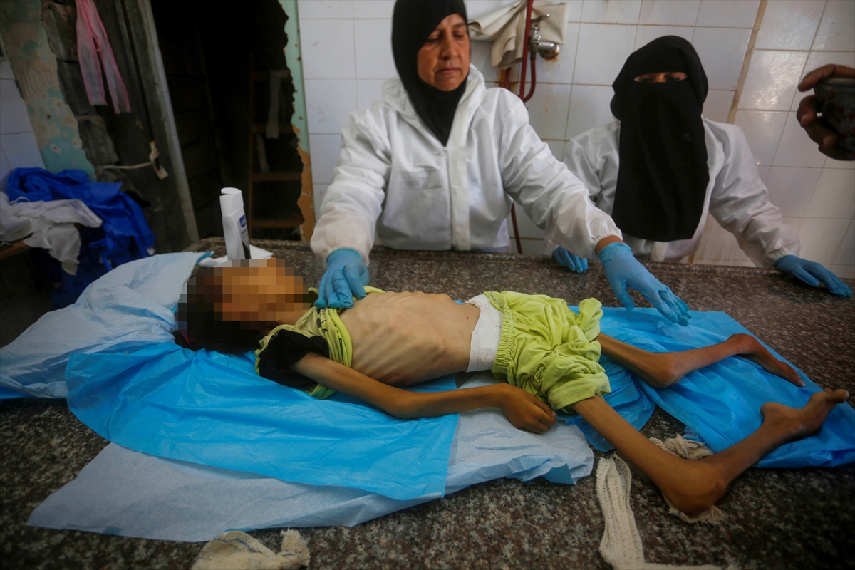 A A 20250912 39093338 39093333 G A Z Z E D E Y E T E R S I Z B E S L E N M E N E D E N I Y L E 10 Y A S I N D A K I A M I N E H A Y A T I N I K A Y B E T T I