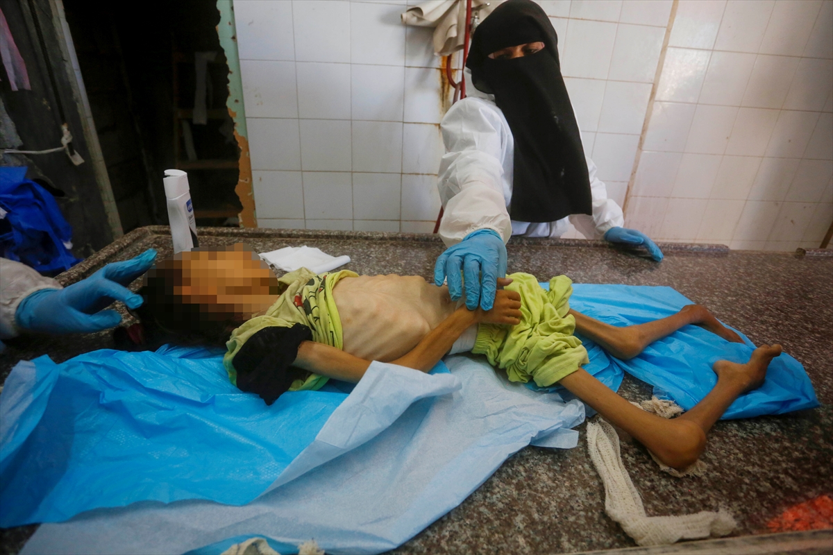 A A 20250912 39093338 39093334 G A Z Z E D E Y E T E R S I Z B E S L E N M E N E D E N I Y L E 10 Y A S I N D A K I A M I N E H A Y A T I N I K A Y B E T T I